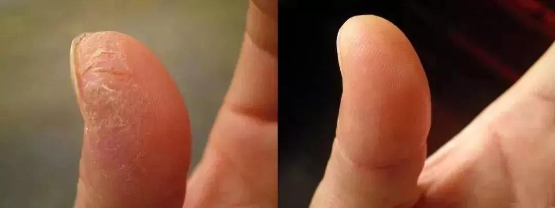 祛除角质细纹的护手霜,干裂护手霜秋冬季