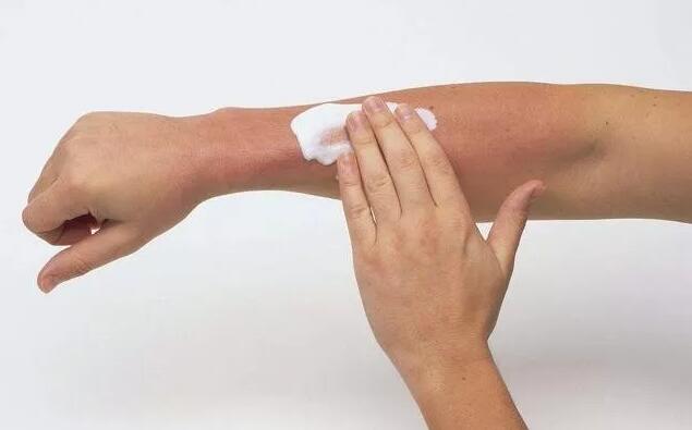 7岁孩子甲醛过敏症状,4岁女儿咳嗽得厉害怎么治疗