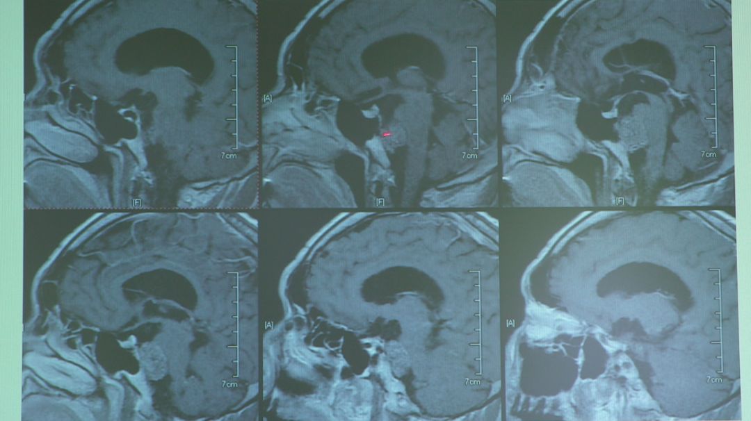 关于医疗纪录片推荐,不煽情却感人