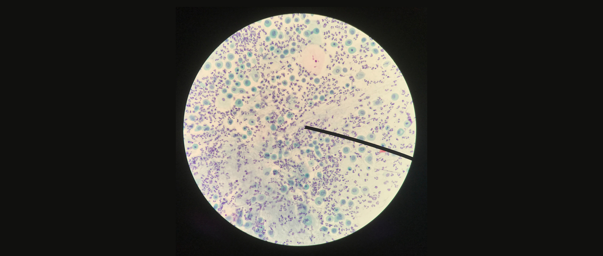 阴道菌群:2020年三大研究进展