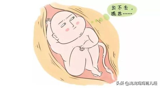 胎儿已经入盆了怎么迟迟不发动,胎儿入盆的表现和症状有哪些