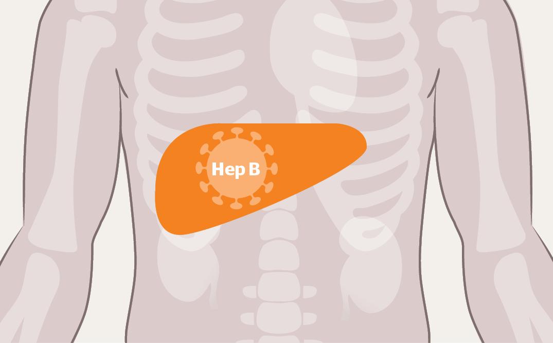 乙肝抗病毒药如何选择,乙肝抗病毒药怎么选择