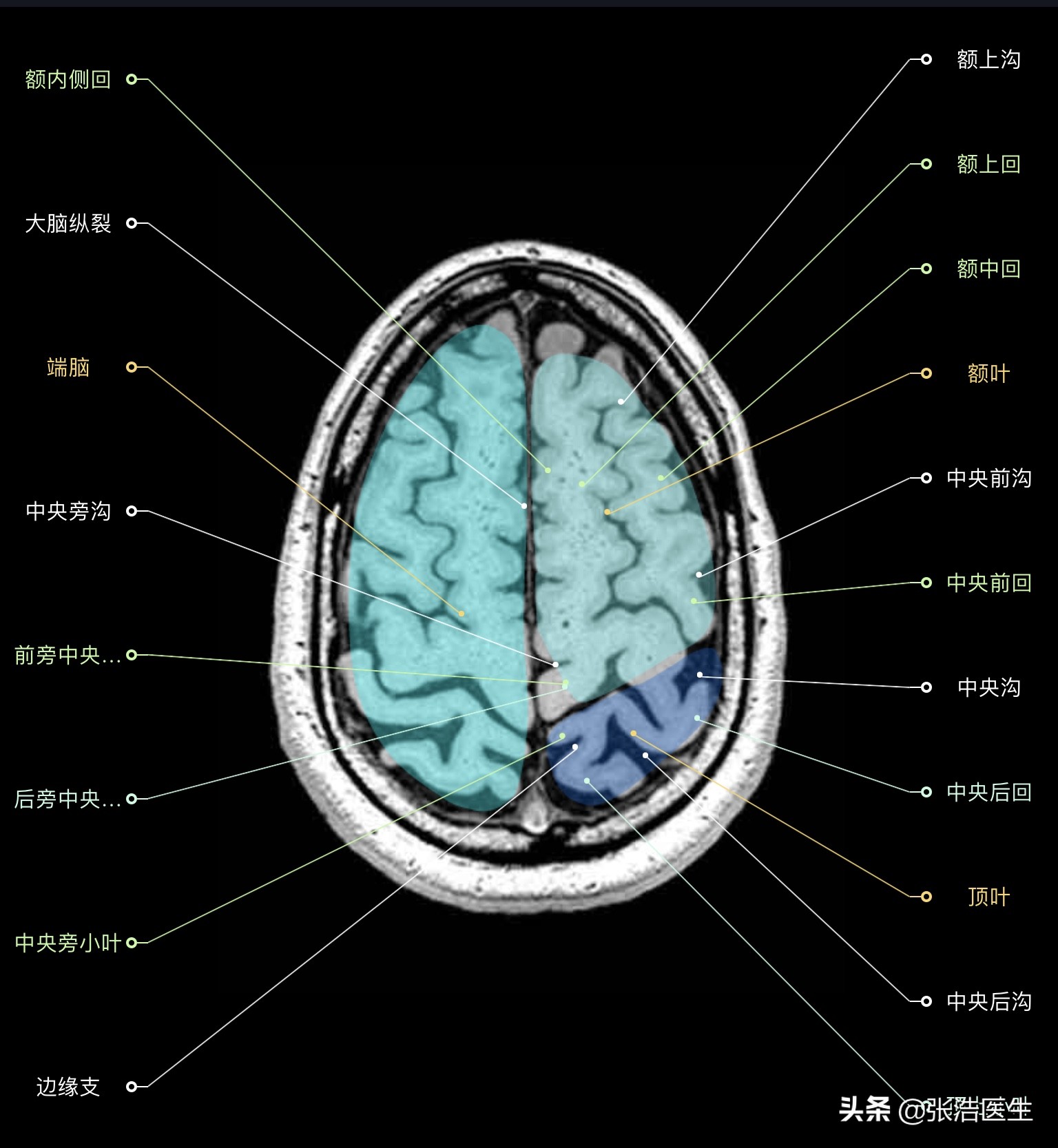 颅脑mri解剖影像检查是什么意思,颅脑mri断层解剖视频课件