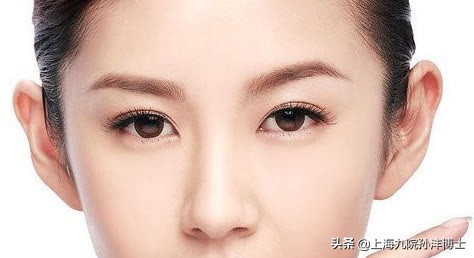 修复双眼皮眼角有分叉怎么办,双眼皮修复折痕分叉