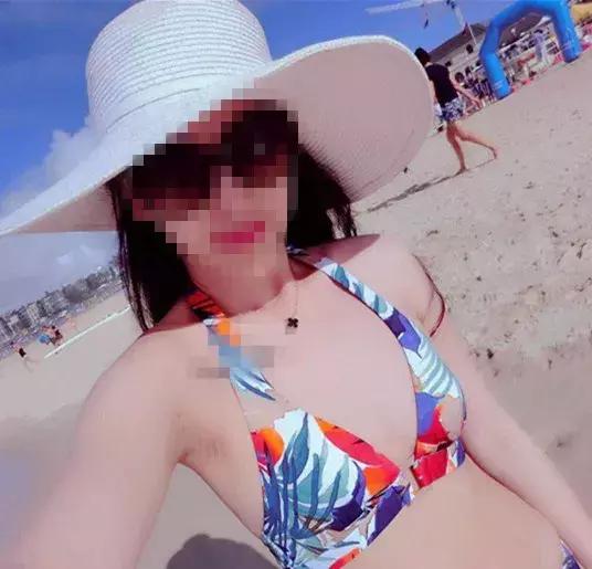 西安女子除妊娠纹,西安女子医院去妊娠纹