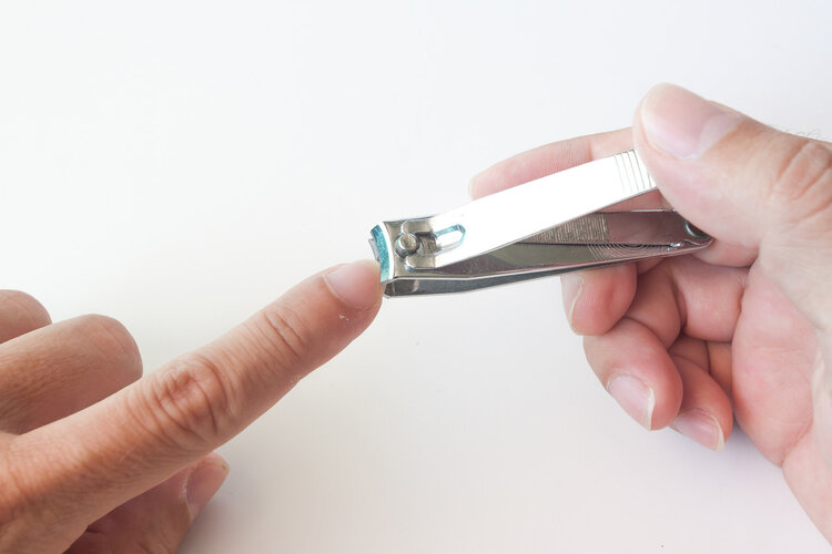 为什么有人指甲上没有月牙,为什么有的人指甲周围没有死皮