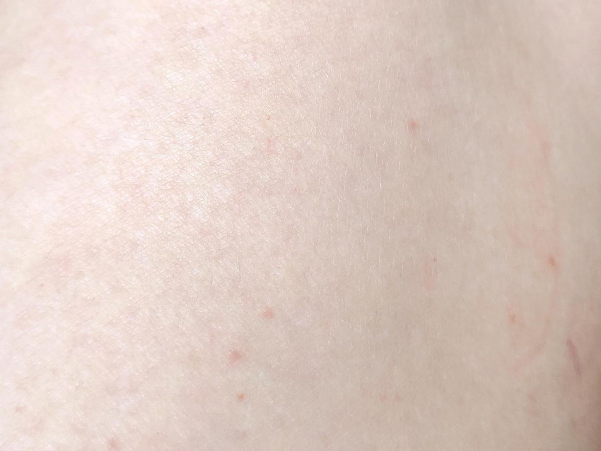 华为hilink脱毛仪脱毛用什么模式,华为hilink脱毛仪测评