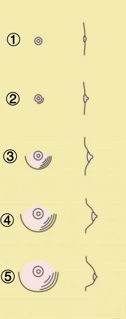 青少年乳腺发育最好的治疗方法,青春期女孩常见的乳腺问题