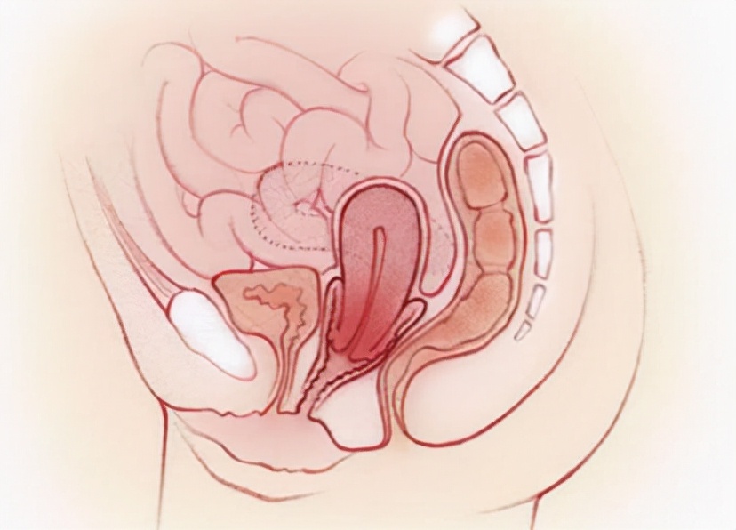 一些妇科问题,妇科疾病哪几种比较严重