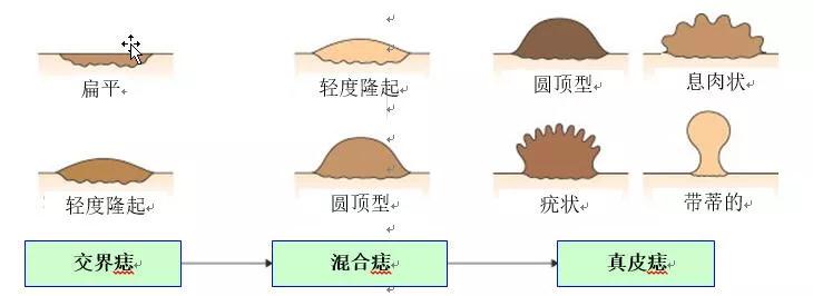 痣用点么,痣能点么