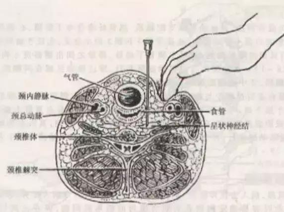 一针治百种病症 (一针治100种病症)