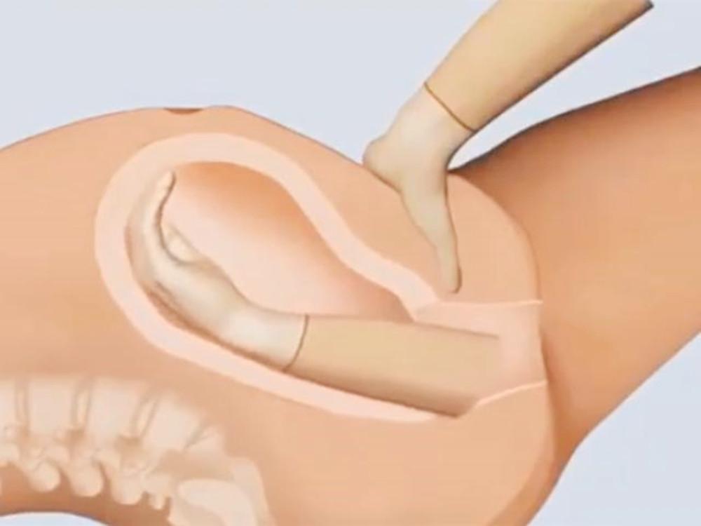 分娩产程的三大阶段,分娩时的产道