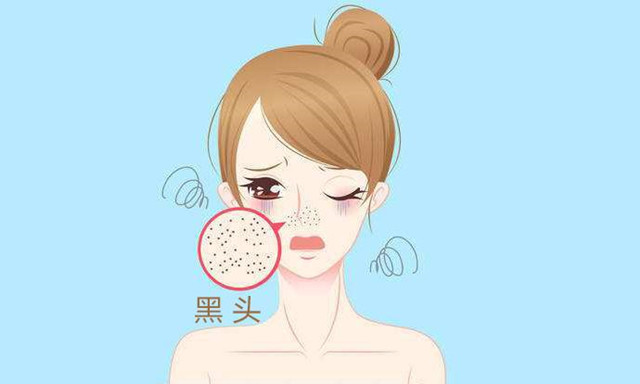 激光祛黑头真的可以去除吗,激光治疗黑头毛孔粗大多少钱