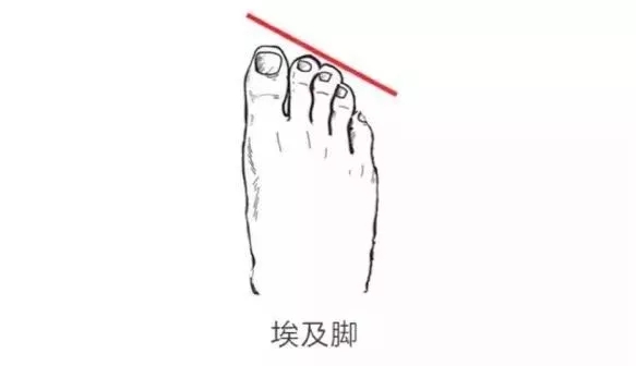 鞋子的种类和适合什么脚穿,如何正确选择舒服的鞋子