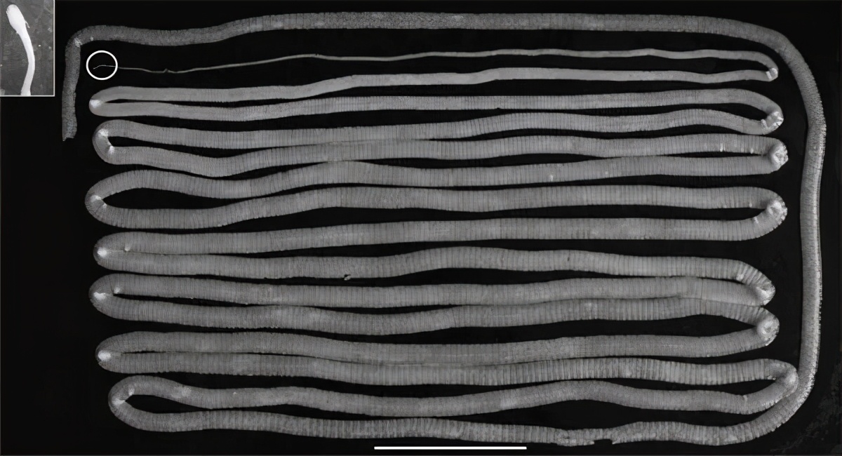 肛拭子有危害吗,肛拭子的好处