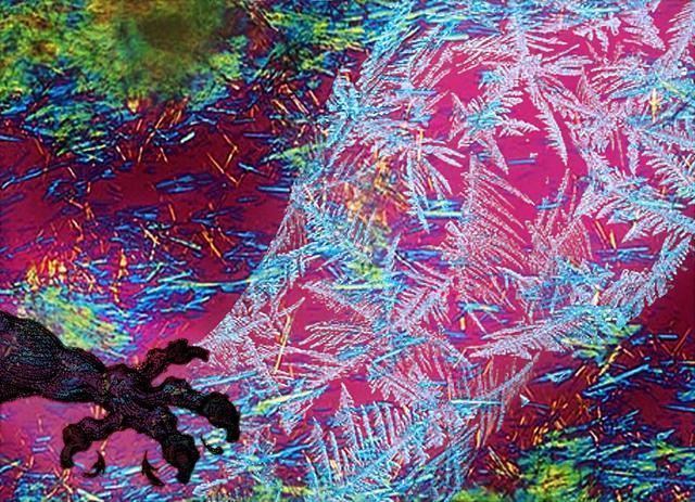 尿酸620需要吃多久的降尿酸药,尿酸486没有症状需要吃药降尿酸吗