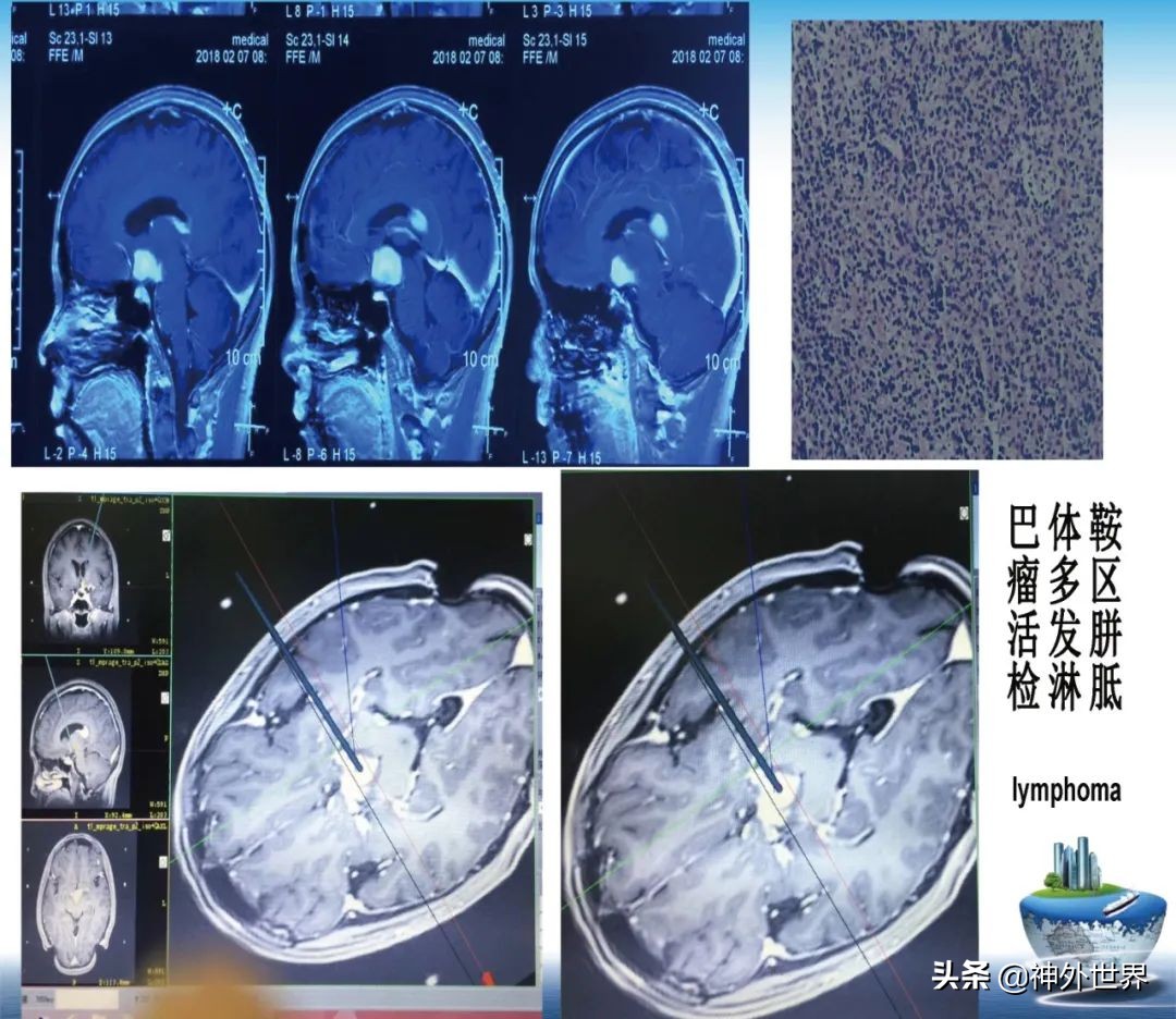 宣武医院神经外科王亚明祖籍,北京宣武医院神经科专家王亚明