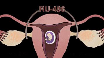 打胎有多可怕案例,20岁女生堕胎7次