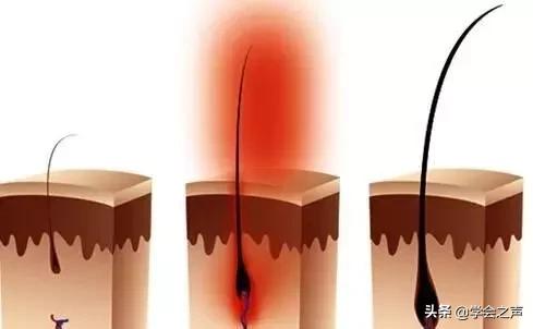 亲测有效的防脱发小技巧,脱发严重这个防脱发妙招很好用