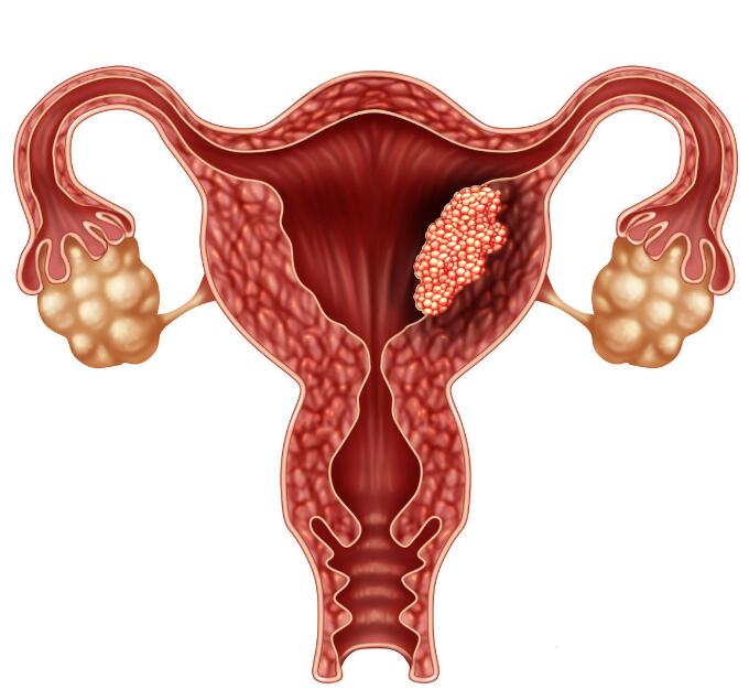 子宫位置前位怎么容易受孕,弓形子宫怀孕的几率是多少