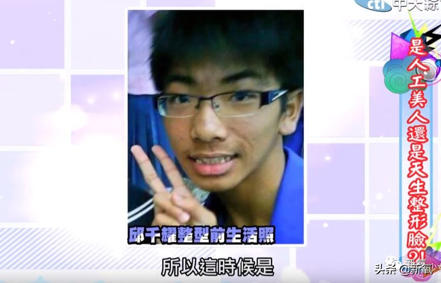 花90万从头整到脚，还可以这么自然？旁边纯天然小姐姐都看懵了