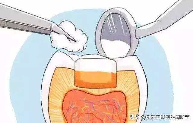 正确的刷牙方法是横刷法对不对,刷牙方法是横刷法还是竖刷牙法