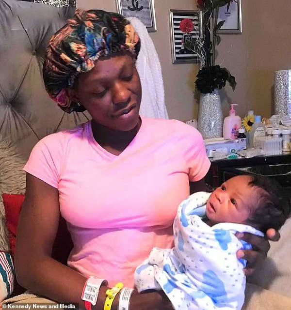 最美胎记小女孩,最美胎记女孩子