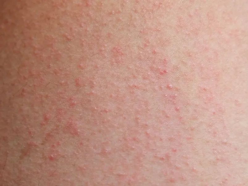 建水人注意了这东西不能碰,来建水了要注意什么