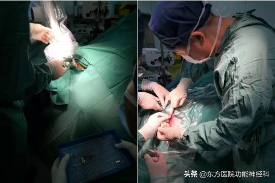 东方医院带你探究DBS能治疗哪些病？