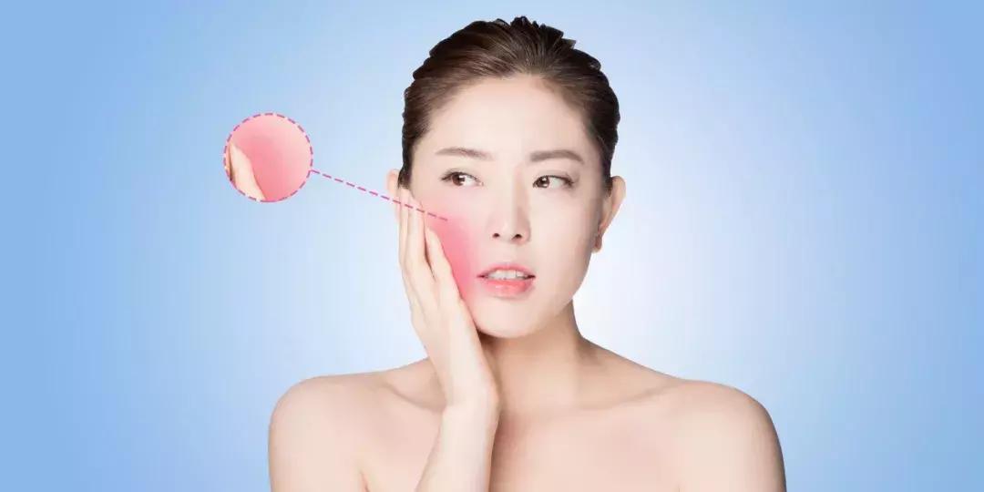 激素脸怎么形成的原因,激素脸有什么特征