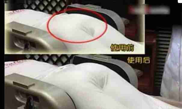 产后骨盆修复是不是盆底肌修复,产后修复盆底肌和骨盆修复怎样做