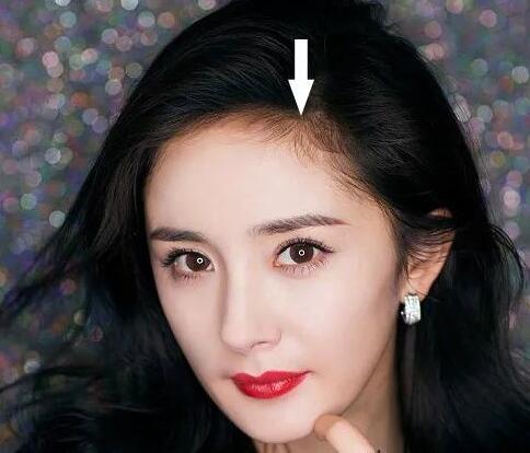 头发细软贴头皮怎么改善,头发细软贴头皮