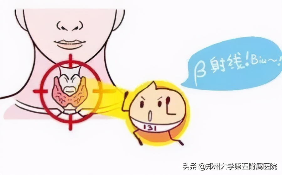 喝碘131后就瘦了几斤正常吗,碘131后有瘦下来的吗