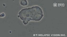 同样的癌症，一个活了一年，一个活了三十年，什么原因？