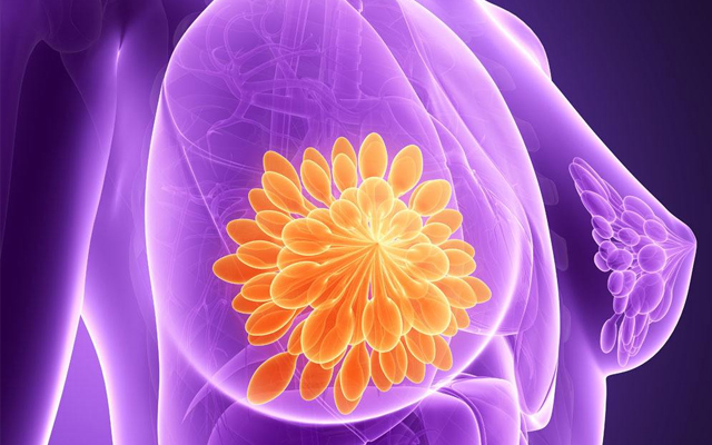 浆细胞性乳腺炎破溃有什么症状,浆细胞乳腺炎破溃后长肉芽了