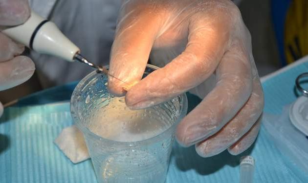 牙齿意外掉落可以救回来吗,牙齿意外脱落3小时可重新装上吗