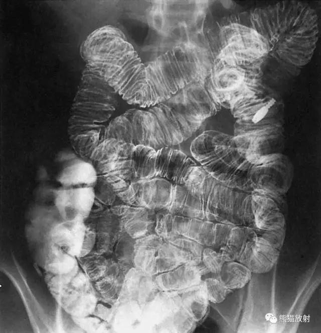 详细的消化道造影+彩色解剖图