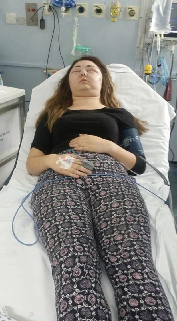 浙江杭州一女子染发过敏,染发剂导致眼睛失明