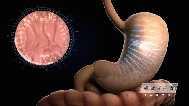 我国首创胶囊机器人，开辟新一代胃镜检查系统，为大国科技点赞