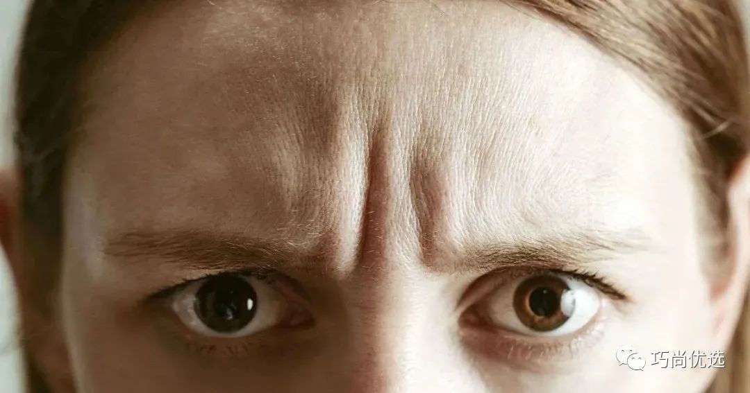 额头皱纹修复最有效的方法,额头皱纹消除最快方法