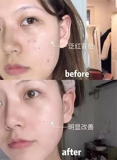cemoy经典水乳,张柏芝推荐水油护肤