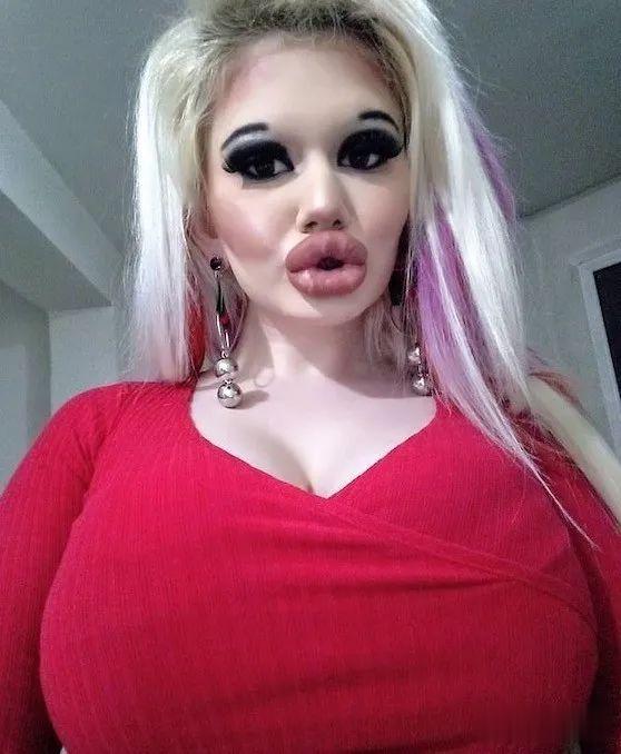 20次整容成功的女人,22岁女人做20次丰唇手术