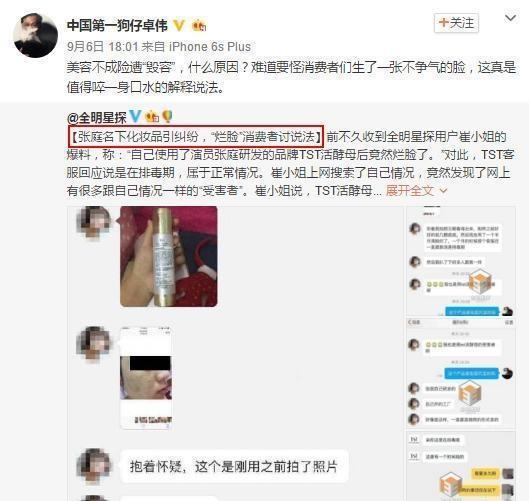 张庭的微商都有哪些,张庭的微商代言