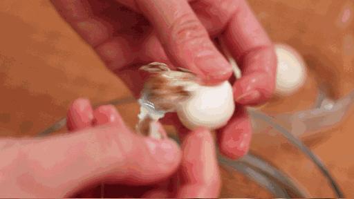 鸭蛋鸡蛋鹅蛋鹌鹑蛋哪个胆固醇高,鸡蛋鸭蛋鹅蛋鹌鹑蛋营养成分表