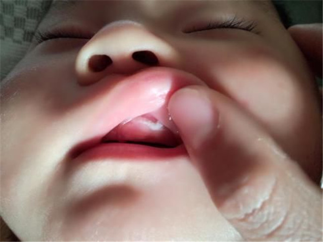 3岁孩子频繁嘟嘴,三岁小孩老嘟嘴