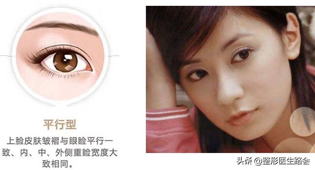 双眼皮多宽好看,双眼皮多宽才好看图片