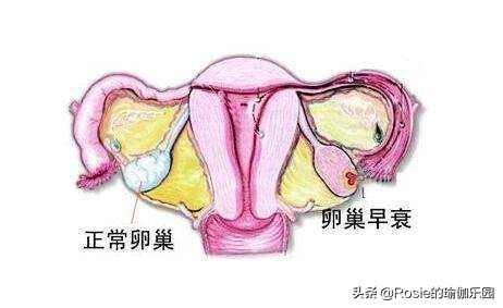 瑜伽哪几个动作可缓解盆腔压力,适合生闷气的人做的瑜伽