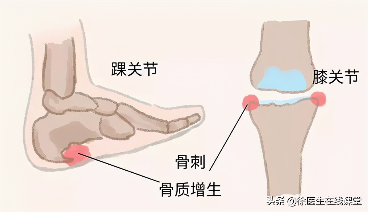 老年人脚底板疼是怎么回事,老年人脚底板痛怎么解决