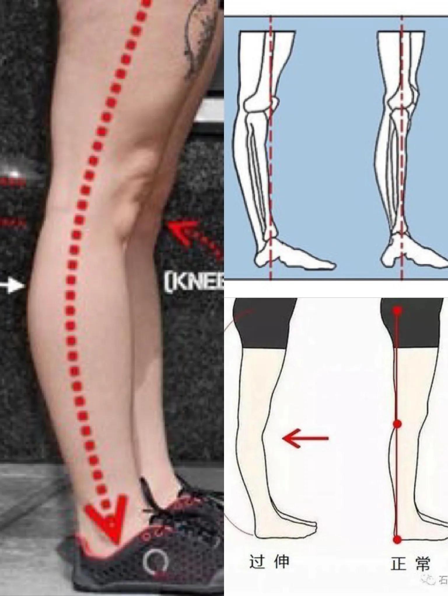如何改变腿粗的腿型,你必须要改掉的七个坏习惯