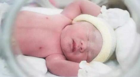 2斤早产儿智力发育,早产儿有脑损伤会影响智力发育吗